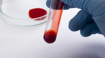 أنواع الثلاسيميا