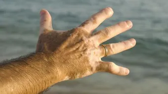 أنواع البهاق