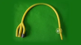 أضرار قسطرة البول