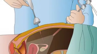 التنظير الرّحمي