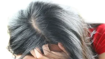 فيتامين ب6 للشعر