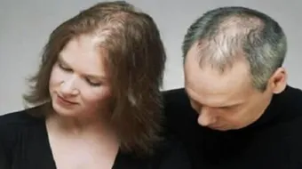 نقص فيتامين د يسبب تساقط الشعر