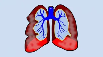 الماء في غشاء الرئة