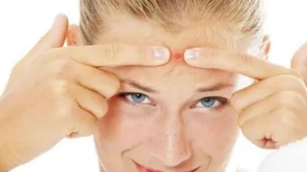 طرق للتخلص من حب الشباب نهائياً