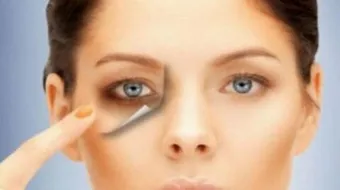 طرق للتخلص من الهالات السوداء