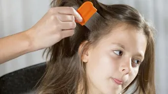 طرق التخلص من القمل نهائياً