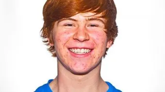 طرق لإزالة حب الشباب نهائياً