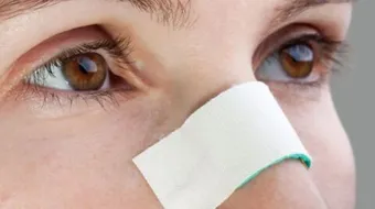 طرق إزالة الزيوان