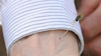 ما علاج قرصة النحل