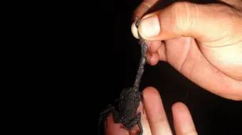 ما علاج لدغة العقرب