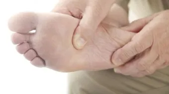 ما علاج مسمار القدم