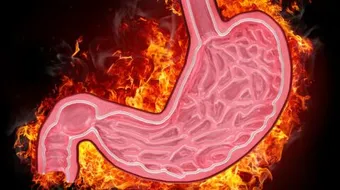 ما علاج المعدة