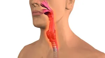 ما هي أمراض الحلق