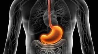 ما هي أسباب الحموضة في المعدة