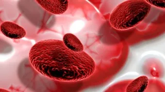 ما أسباب فقر الدم وعلاجه