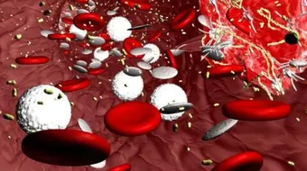 ما هي أسباب تخثر الدم