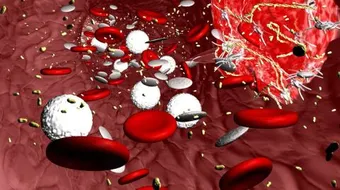 ما أسباب تخثر الدم