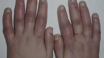 ما أسباب تورم الجسم