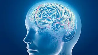 ما أسباب جلطة الدماغ