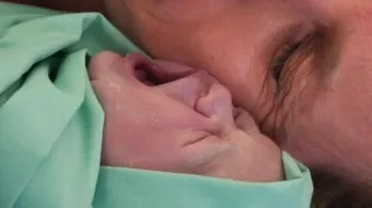 ما أسباب العملية القيصرية