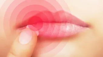 ما أسباب تشقق الشفاه