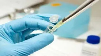 ما أسباب نقص هرمون الاستروجين