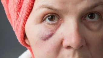 ما أسباب تورم الوجه