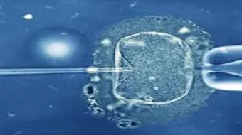 ما هي أسباب فشل أطفال الأنابيب