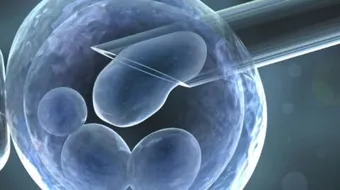 ما هي أسباب فشل التلقيح الصناعي