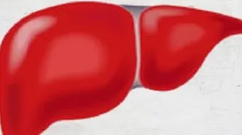 ما هي أسباب تضخم الكبد