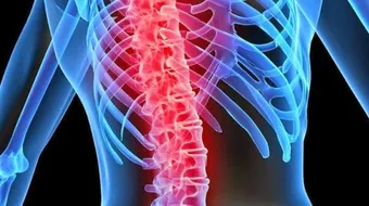 ما هي أسباب ألم أسفل الظهر