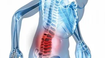 ما أسباب أوجاع أسفل الظهر
