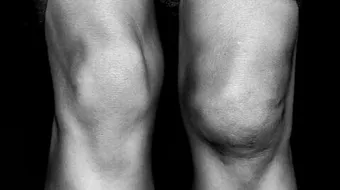 ما هي أسباب تورم الرجلين