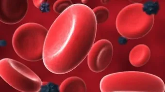 ما هي علامات فقر الدم