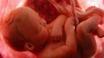 ما هي مراحل تكوين الجنين