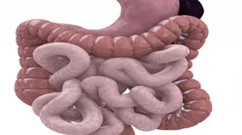 ما هي أعراض تهيج القولون