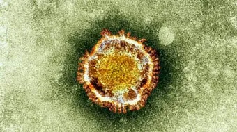 ما هي أعراض الكورونا