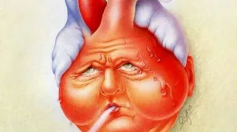 ما هي أعراض قصور الشريان التاجي