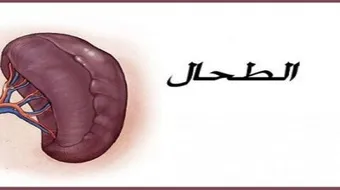 ما هي أعراض أمراض الطحال