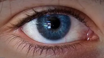 ما هي أعراض بعد النظر