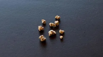 ما هي أعراض حصوات المرارة