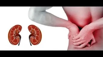 ما هي أعراض عجز الكلى