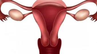 ما هي أعراض ضعف المبايض