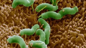 ما هي عوارض جرثومة المعدة