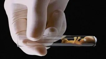 ما سبب فشل أطفال الأنابيب