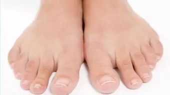 ما أسباب برودة القدمين