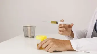 ما سبب تغير لون البول الى الأصفر الغامق