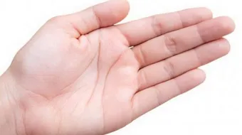 ما سبب خدر اليدين