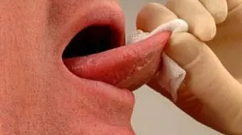 ما أسباب خدر اللسان