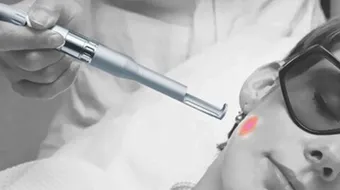 ما أضرار الليزر